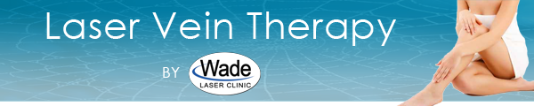 laser vein treatments