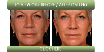 DOT Therapy before and after