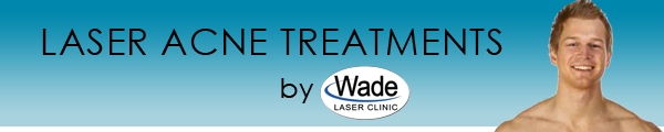 Acne Treatments Utah